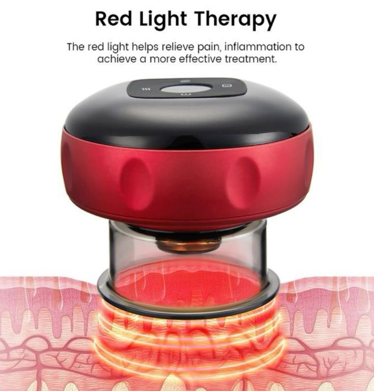 AthleZone Electric Cupping Therapy Machine